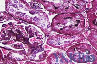 重庆六胺银染色