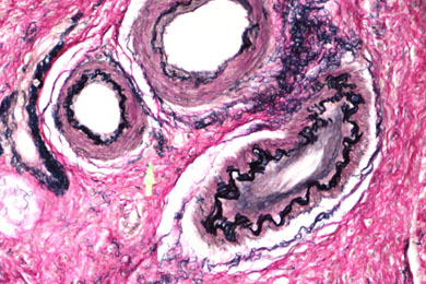 重庆弹力纤维染色