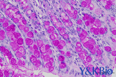 重庆糖原PAS染色