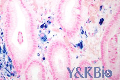 重庆普鲁士蓝染色