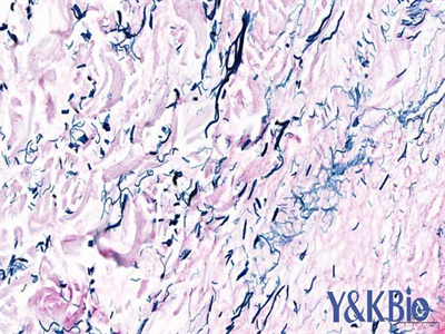 重庆维多利亚蓝染色