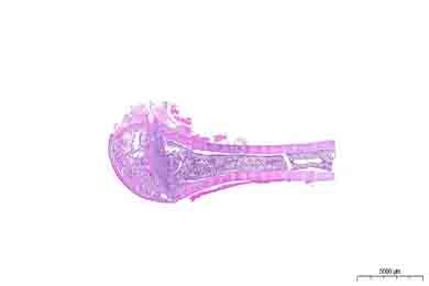 重庆脱钙（慢脱）