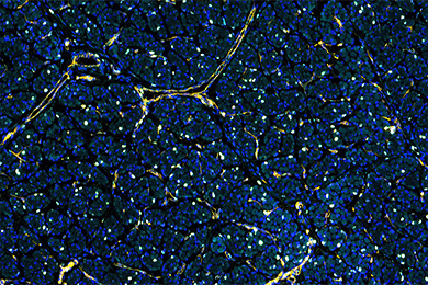重庆普通切片免疫荧光五标（六色）染色