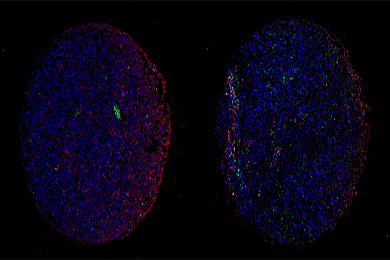重庆组织芯片免疫荧光单标（双色）染色