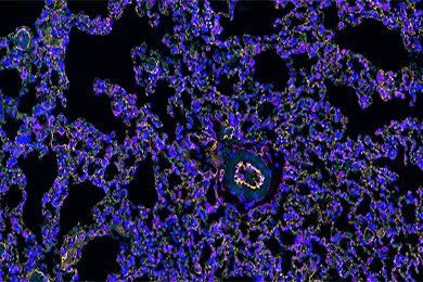 重庆组织芯片免疫荧光双标（三色）染色