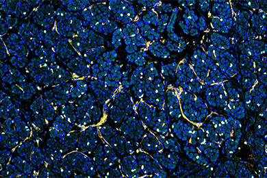 重庆普通切片（荧光四标 五色）扫描