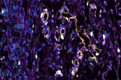 重庆普通切片（荧光五标