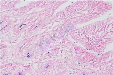 重庆革兰氏染色