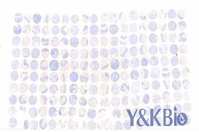 重庆白光芯片扫描