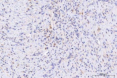 重庆Anti-iNOS Antibody