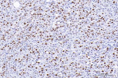 重庆Anti-Ki67 Antibody [SR00-02]