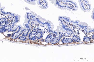 重庆Anti-MMP-2 Antibody [PSH11-26]